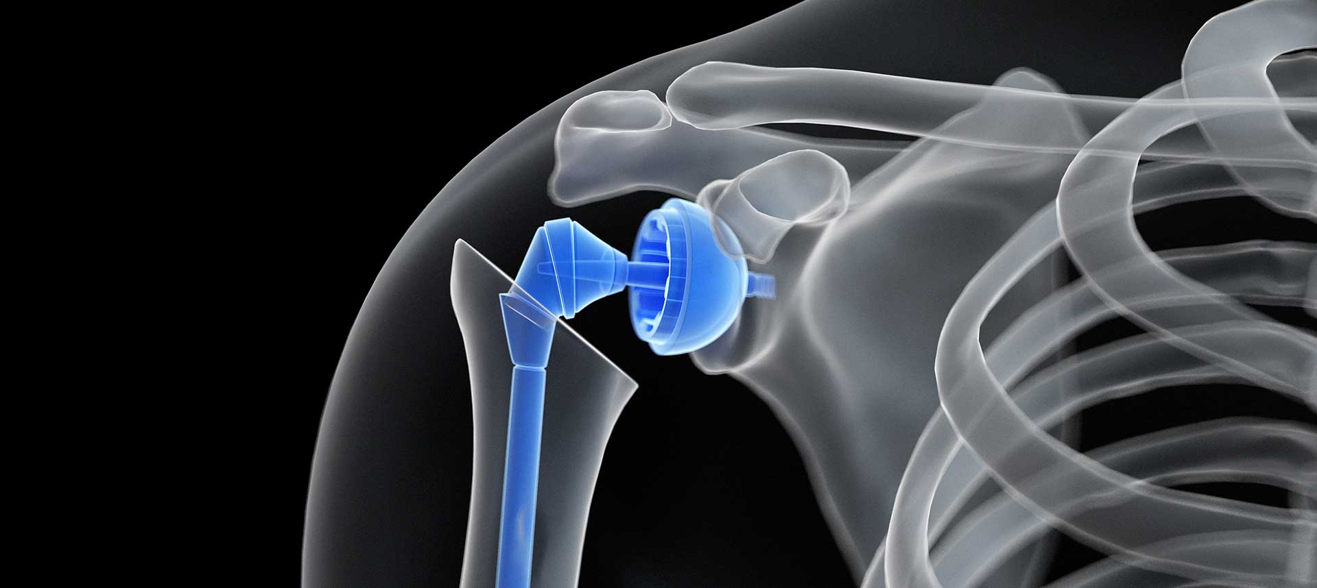 Ortopedide Çığır Açan Teknoloji: Robotik Cerrahi Nedir?